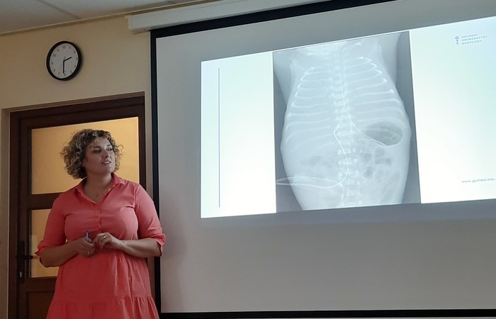 Spotkanie VI 22-23 Zaburzenia rozwojowe wcześniaków, spotkanie z neonatologiem